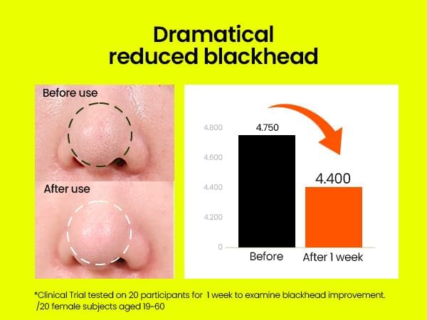 Beplain Mung Bean Cleansing Oil 200ml