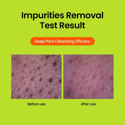 Beplain Mung Bean Oil Care Set for Sensitive Skin – Cleanser 80ml, Clay Mask 120ml & Makeup Remover 200ml