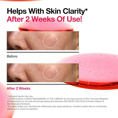 10% Niacinamide+ 4% Tranexamic Acid Serum, Ceramide, Hyaluronic Acid, Vitamin B12 Natural Color, Korean Glass Skin, Fragrance-Free, Korean Skincare, 30Ml /1.01 Fl.Oz.