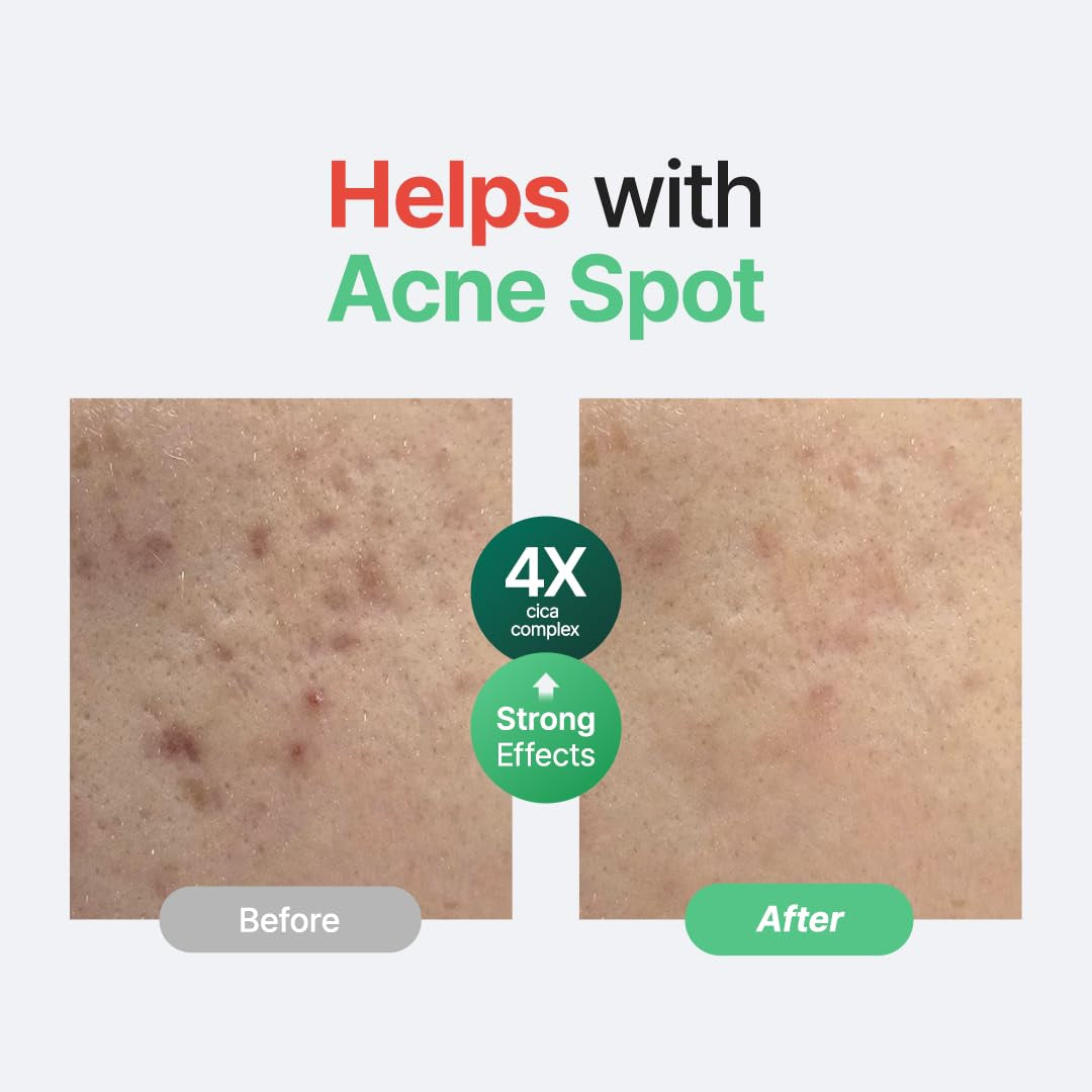 Purito Seoul – Wonder Releaf Centella Serum Unscented (60ml)