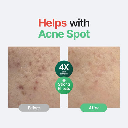 Purito Seoul – Wonder Releaf Centella Serum Unscented (60ml)